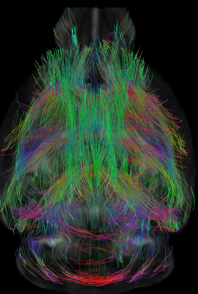 The Yin Lab Laboratory Of Neurometabolism And Neuroinflammation